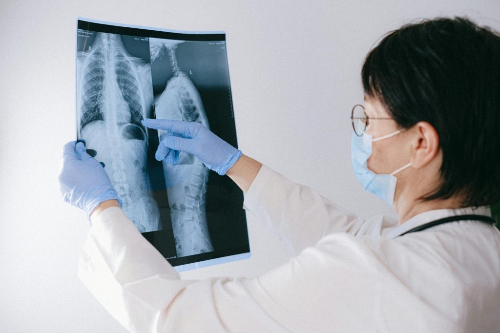 a doctor holding an x ray result